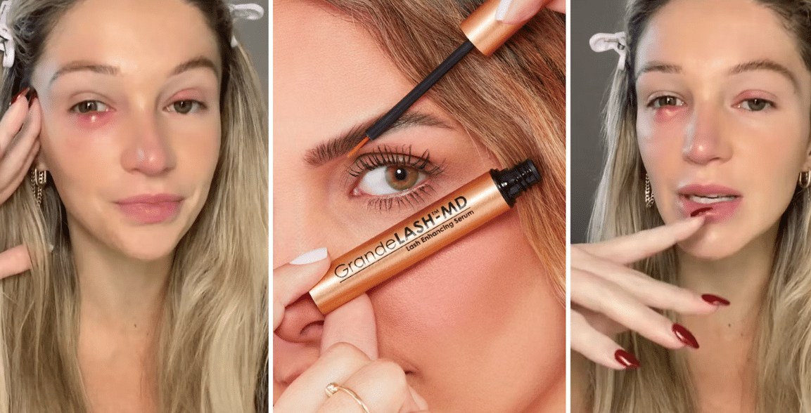 Grande Lash Lawsuit